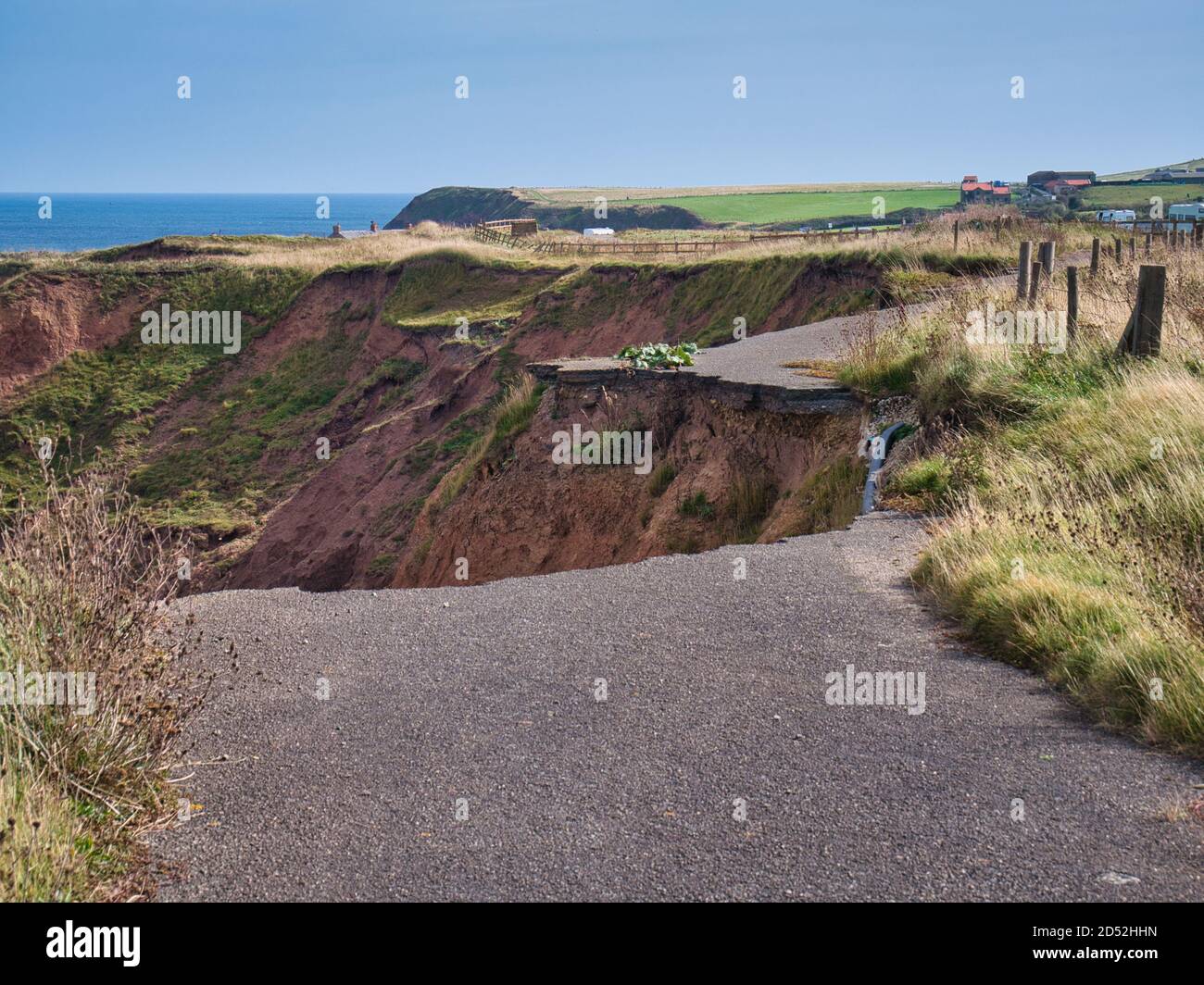 Ein Abschnitt des Küstenweges des Cleveland Way in der Nähe von Staithes in North Yorkshire, Großbritannien, verlor durch Einsturz des Bodens aufgrund von Küstenerosion. Stockfoto