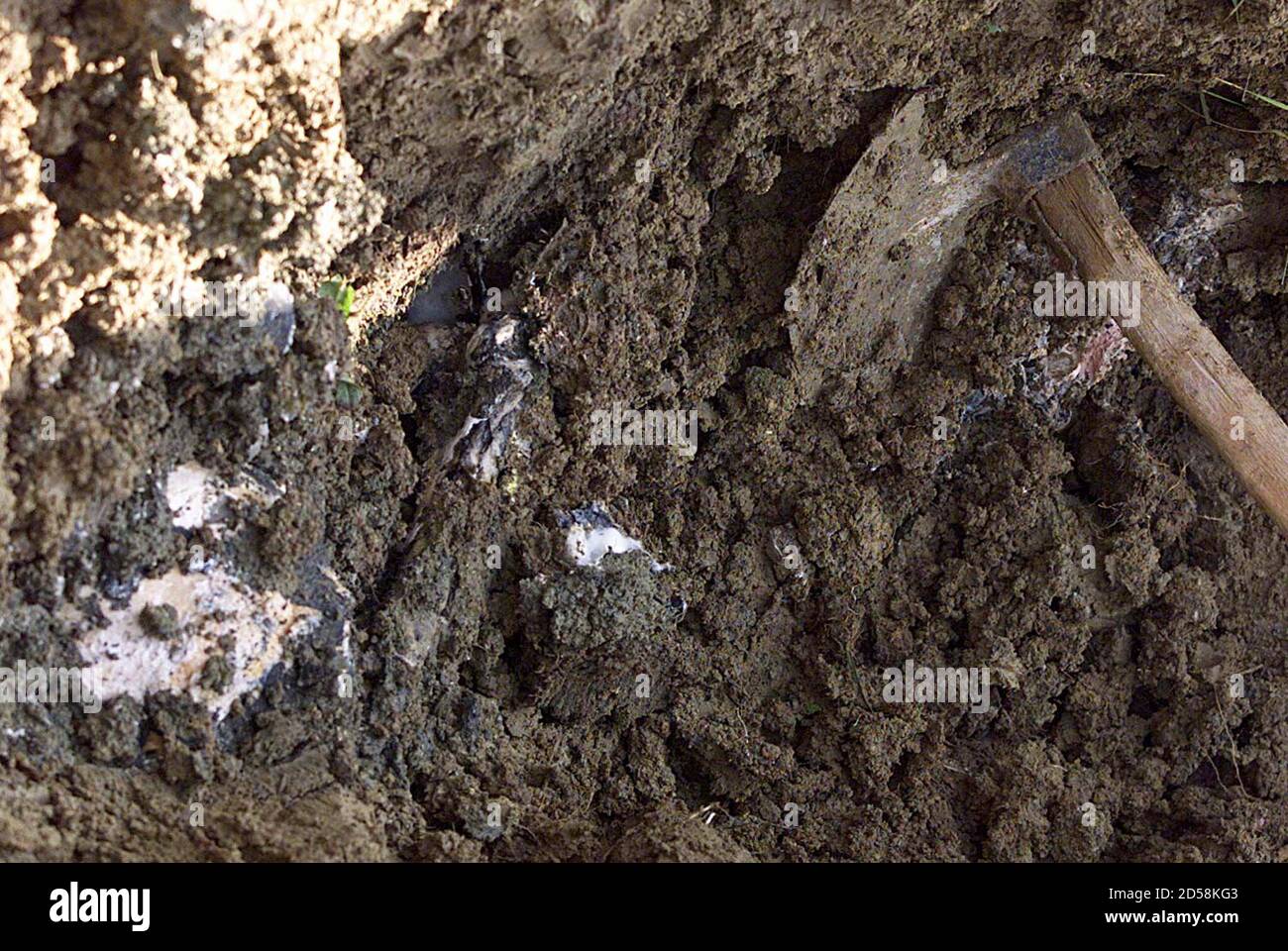 Verbrannte Menschliche Knochen Stockfotos Und Bilder Kaufen Alamy