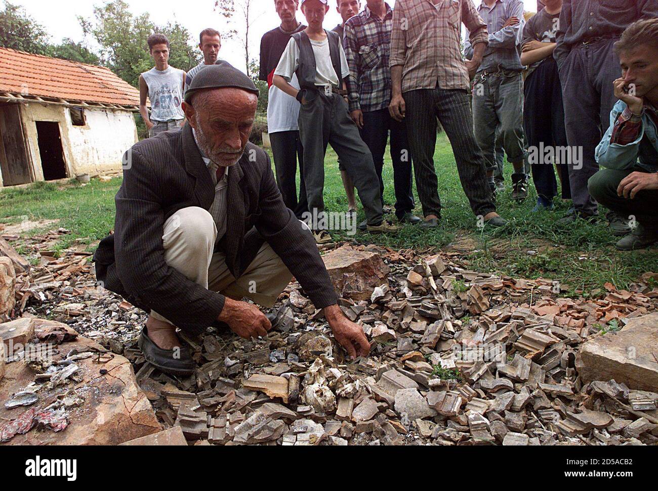 Verbrannte Menschliche Knochen Stockfotos Und Bilder Kaufen Alamy