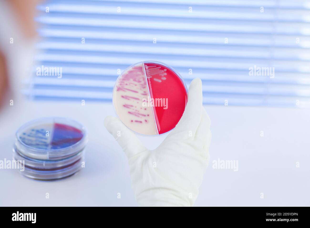 Labortechniker untersucht Agarplatte mit Bakterien Stockfoto