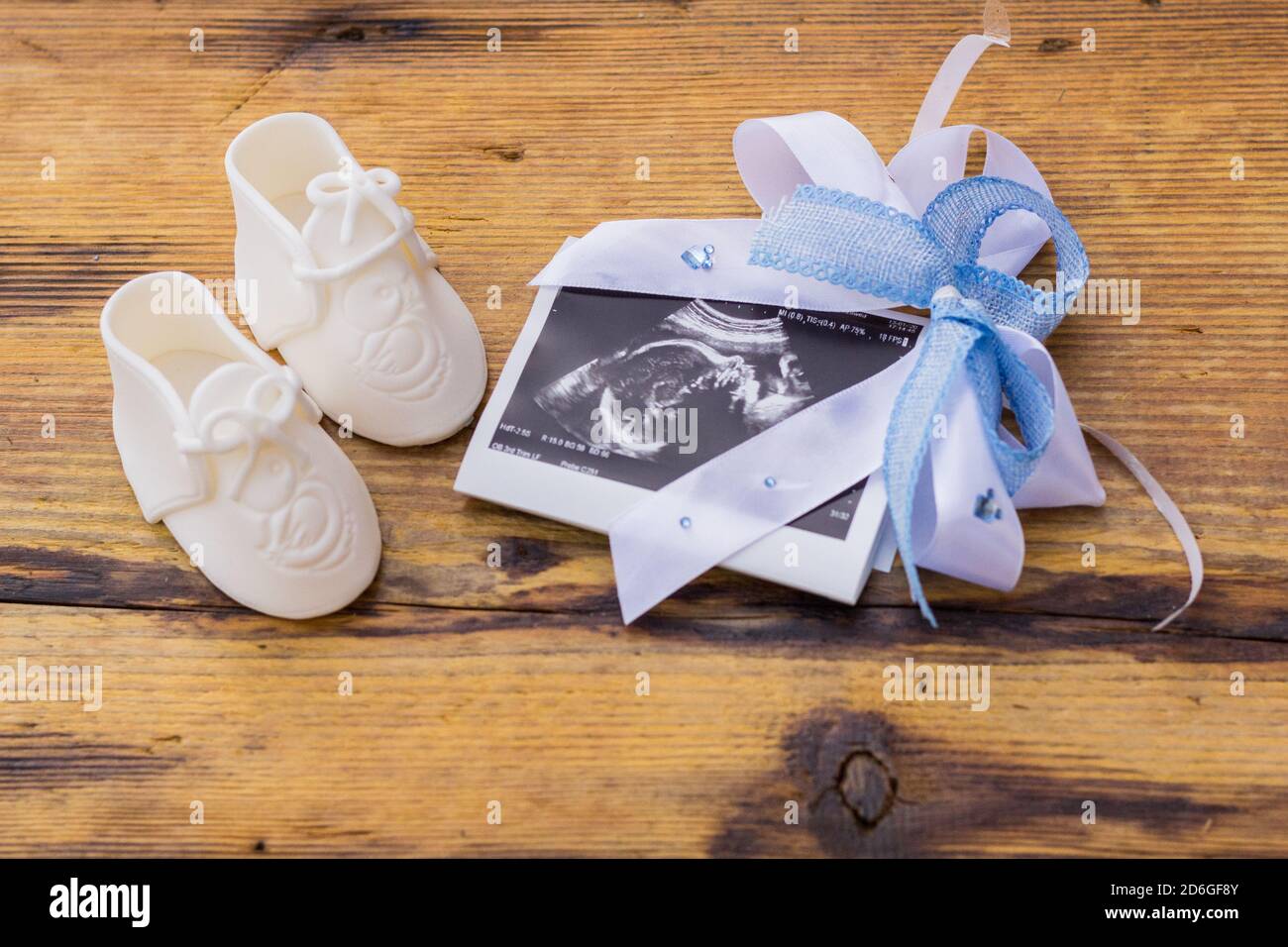 Weiße Babystiefel mit blauer Schleife um Ultraschallbild auf rustikaler Holzoberfläche, Geschlechtsangabe oder Schwangerschaftsankündigung Konzept Stockfoto