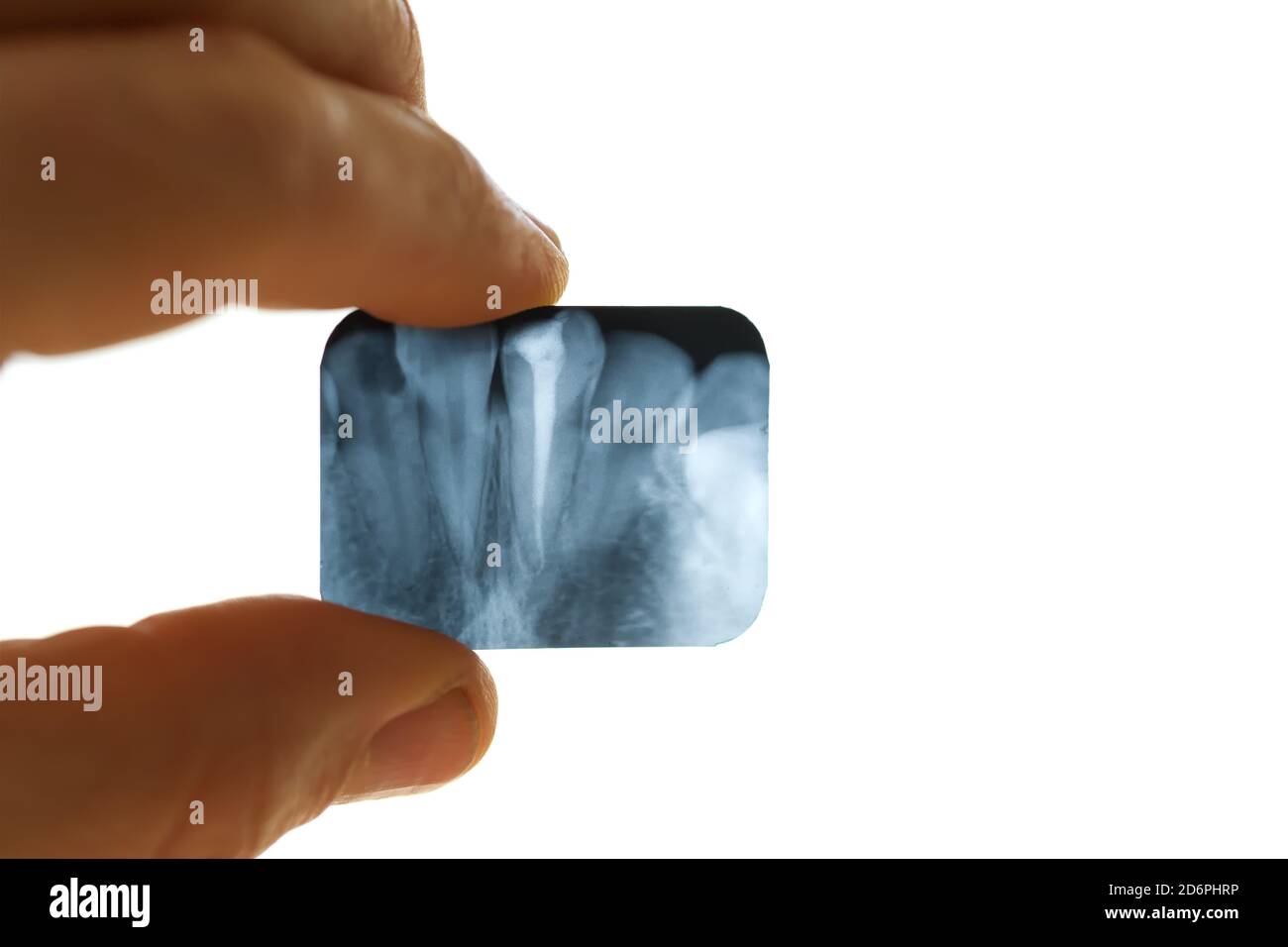 Zahn-Röntgen in der Hand des Menschen Nahaufnahme Stockfoto