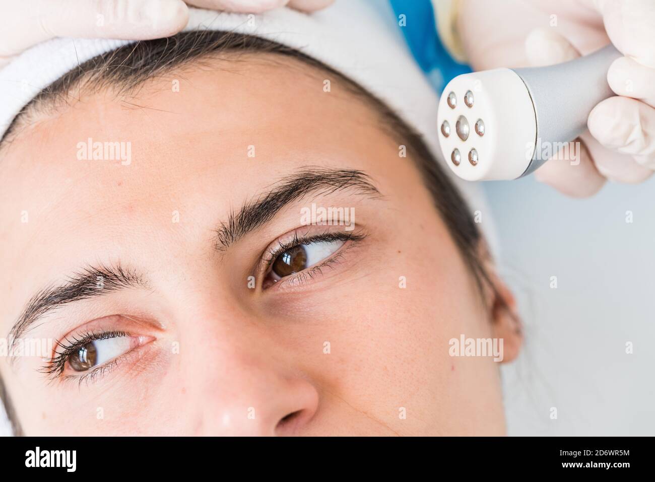 Mikrodermabrasion des Gesichts, eine Technik, die abgestorbene Zellen und Verunreinigungen aus der Epidermis beseitigt, Peeling der Oberflächenschicht der Haut, C Stockfoto