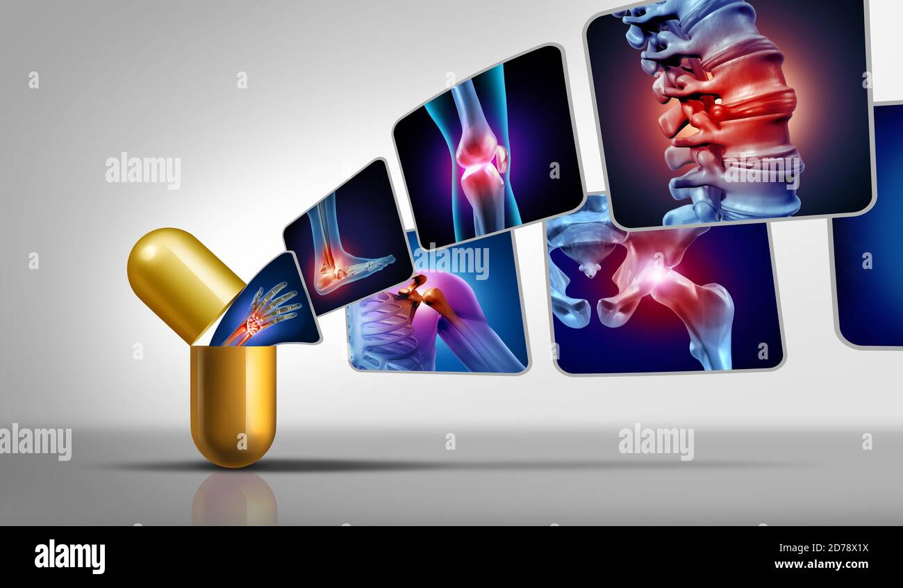 Gelenkschmerzen Medizin und schmerzhafte Verletzungen oder Arthritis Medikation Symbol für die Gesundheitsversorgung und medizinische Symptome Behandlung mit 3D-Illustration Elemente. Stockfoto