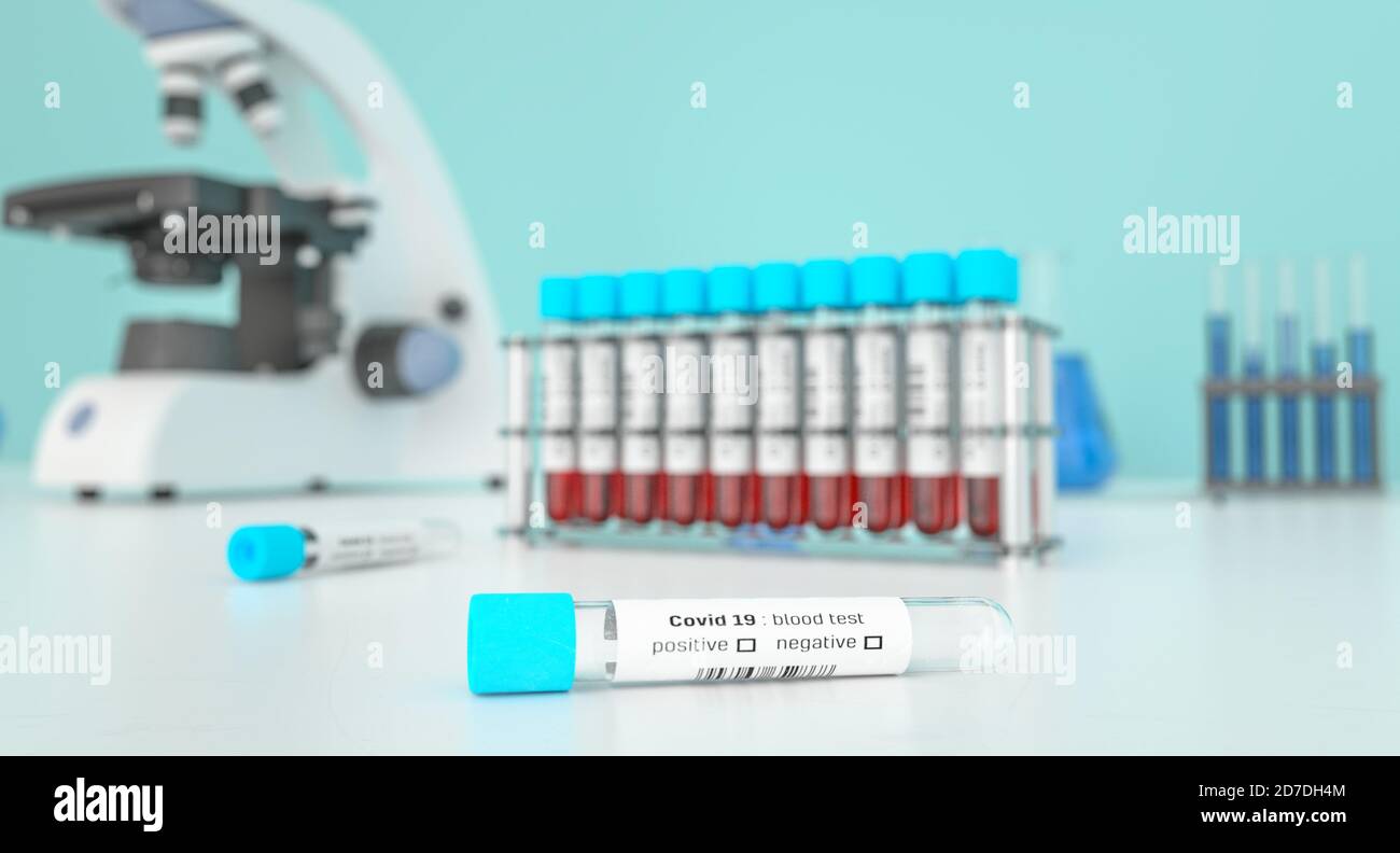 Covid-19 Blutuntersuchung in einem Labor für Coronavirus . Covid medizinisches Screening Coronavirus. Blutproben in Glasröhrchen. 3d-Rendering. Stockfoto