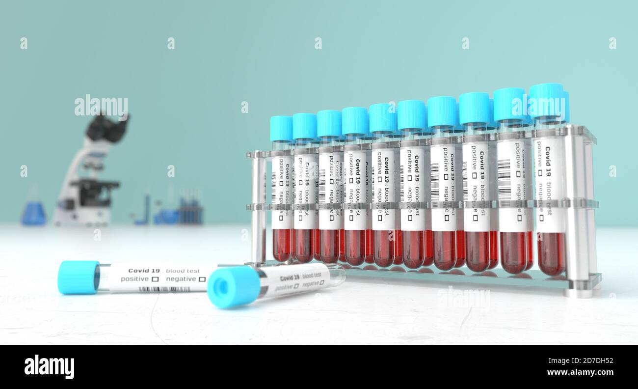 Coronavirus-Bluttests in einem Labor für Covid-19 . Covid medizinisches Screening. Blutproben in Glasröhrchen. 3d-Rendering. Stockfoto