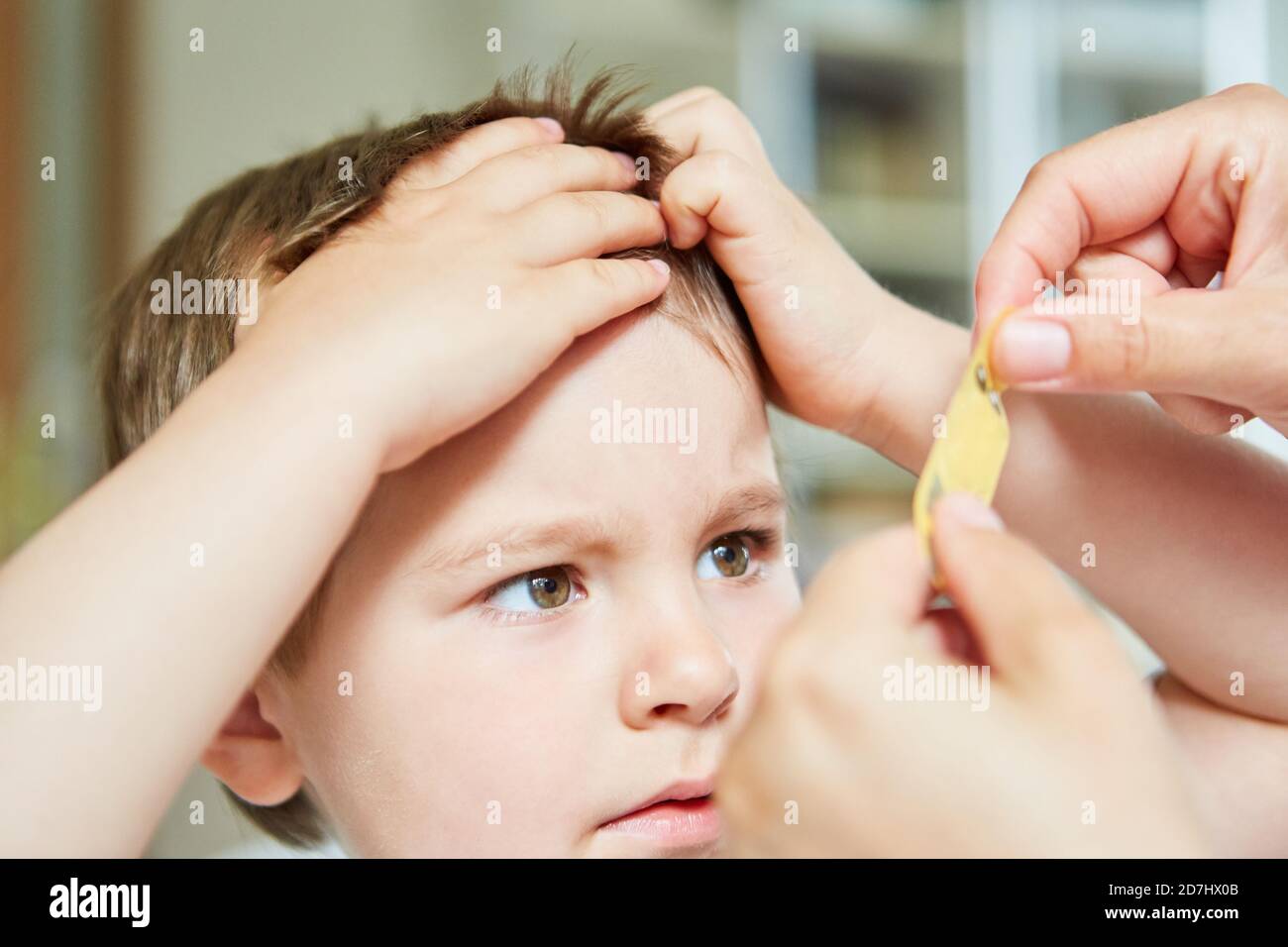 Kind bekommt Gips auf seine Beule auf seiner Stirn an Der Kinderarzt Stockfoto