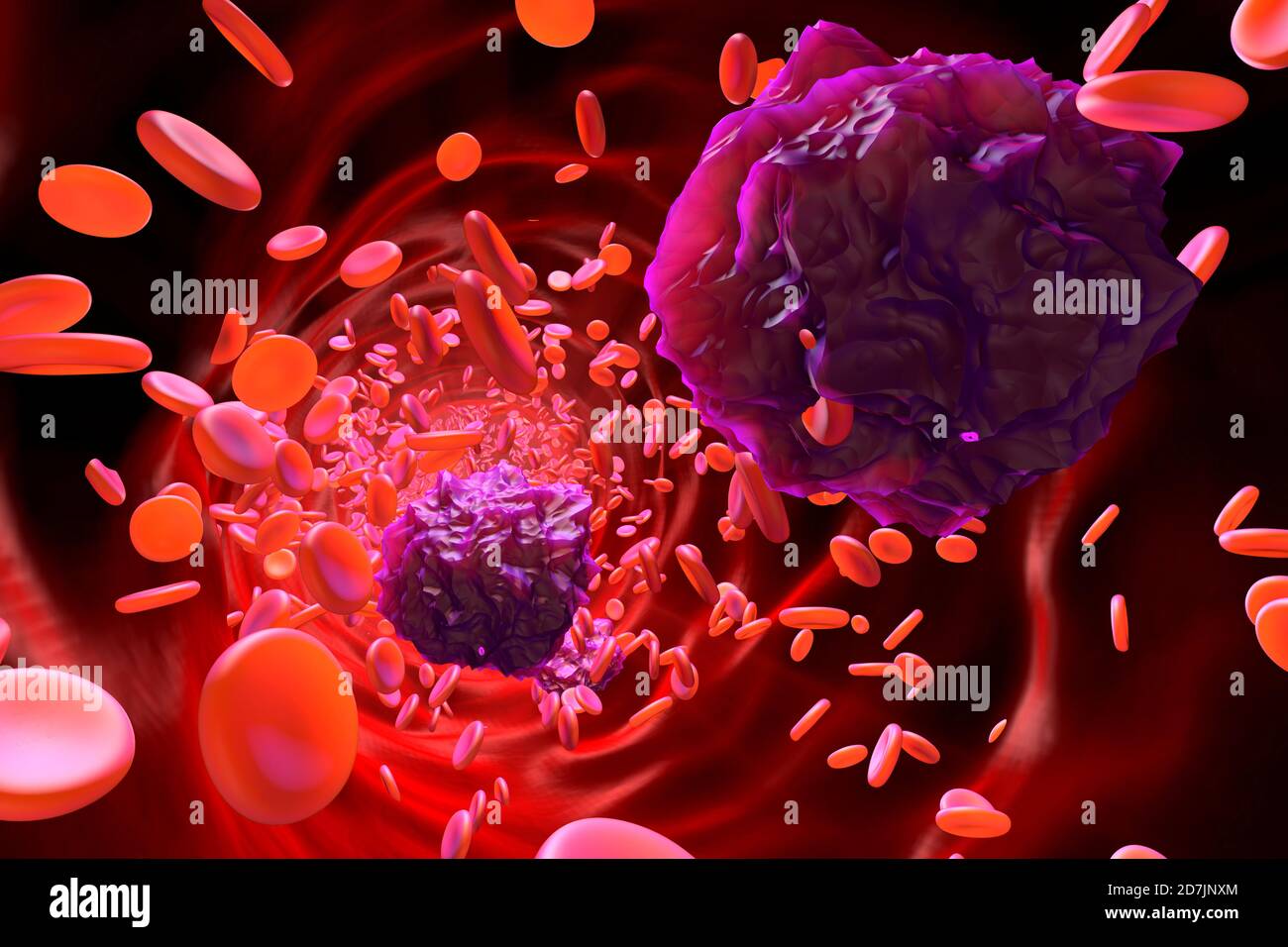 3D Rendering Illustration von Leukämiezellen im Blut Stockfoto