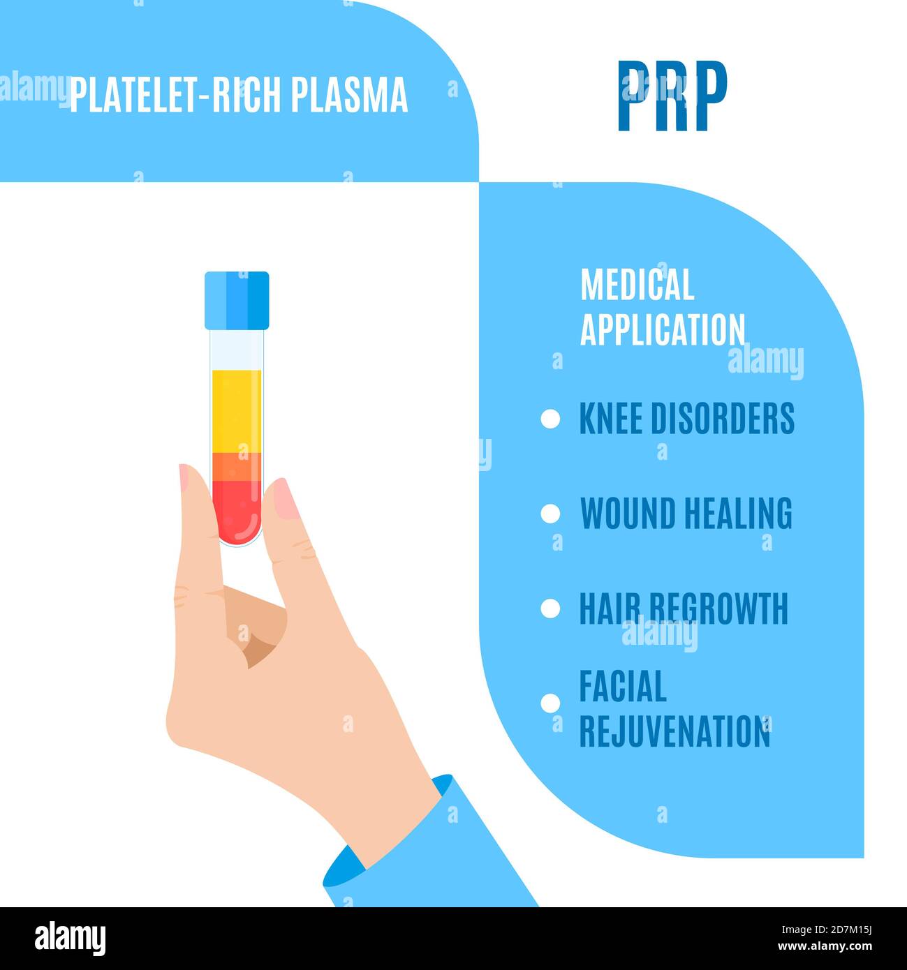 Thrombozytenreiches Plasma (PRP) medizinische Verwendung, Illustration Stockfoto