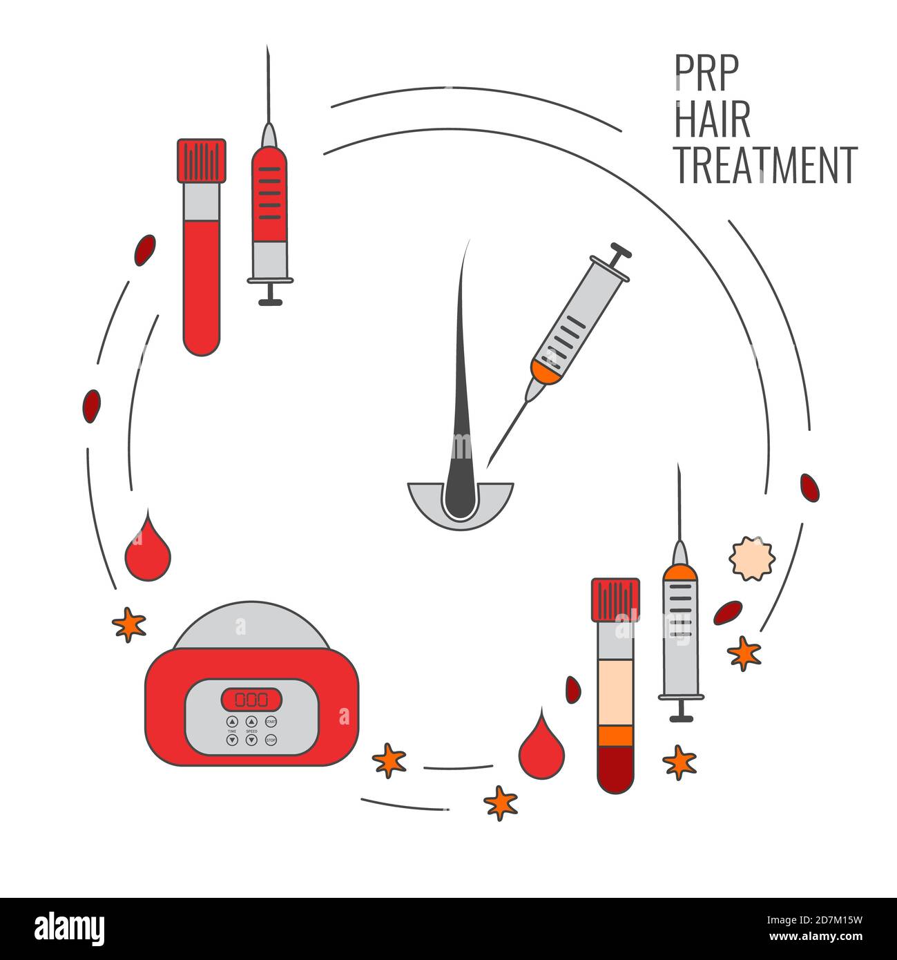 Thrombozytenreiches Plasma (PRP) Behandlung, Illustration. Stockfoto