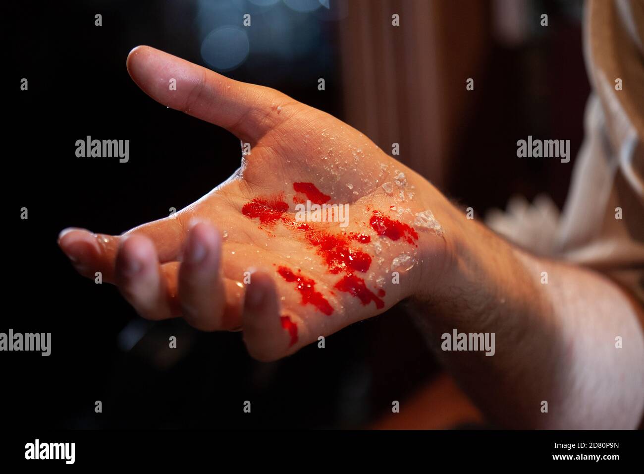 Die Hand des erwachsenen Mannes mit der Wunde aus der Nähe Stockfoto
