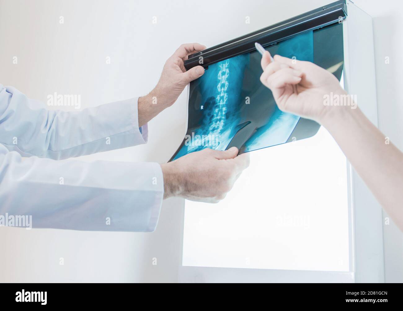 Ansichtsfenster Für Hintergrundbeleuchtung. Röntgenbild-Film-Viewer in der Klinik. Krankenhausausstattung. Röntgenbild der Wirbelsäule. Stockfoto