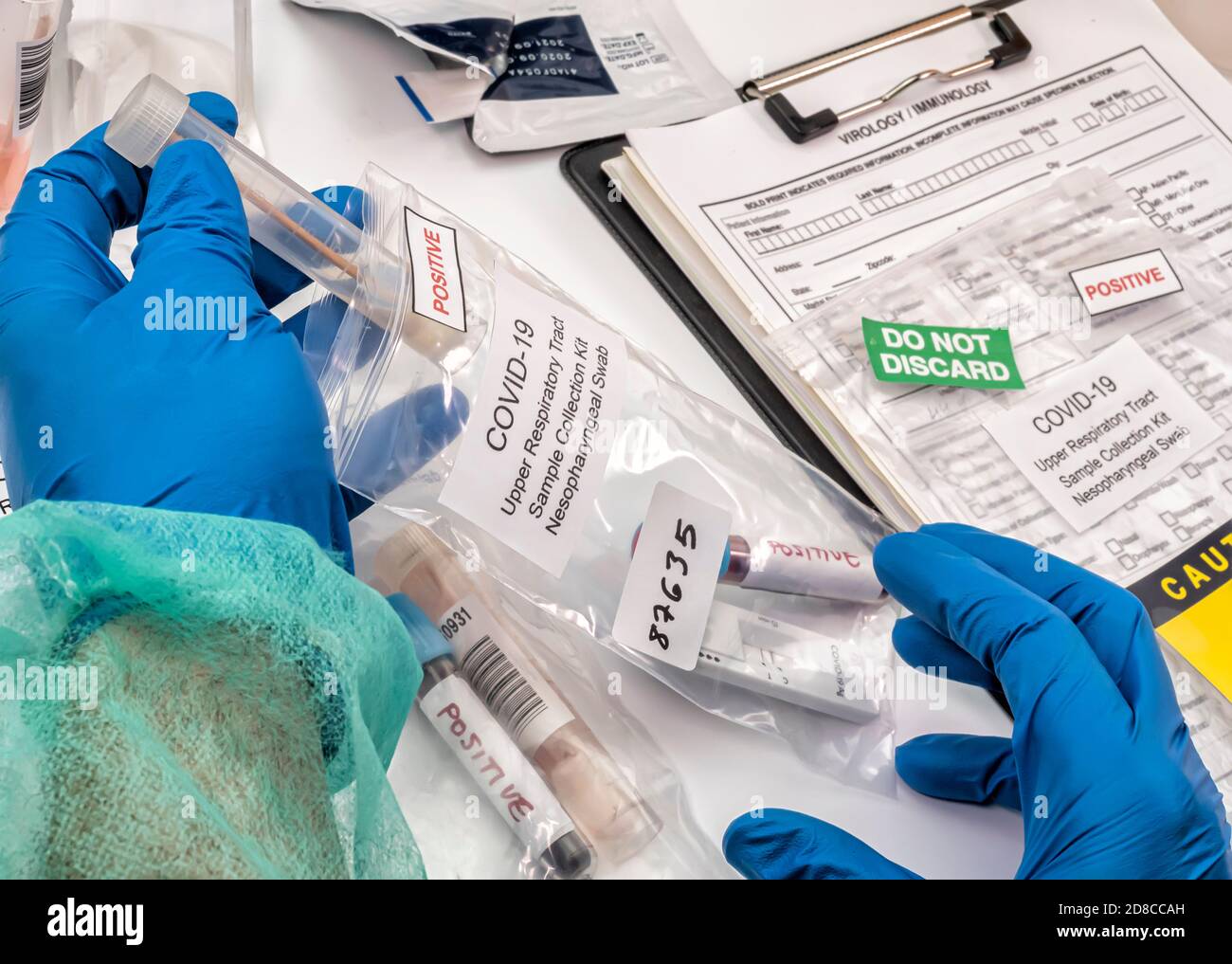 Krankenschwester analysiert positive PCR-Tests von covid-19 in einem Krankenhaus-Labor, konzeptuelles Bild Stockfoto