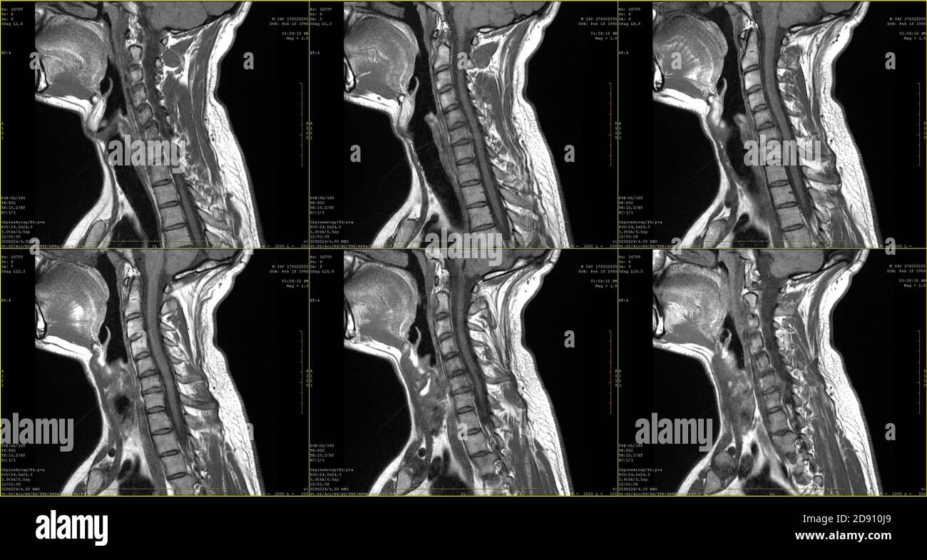 Sagittal Stockfotos und -bilder Kaufen - Alamy
