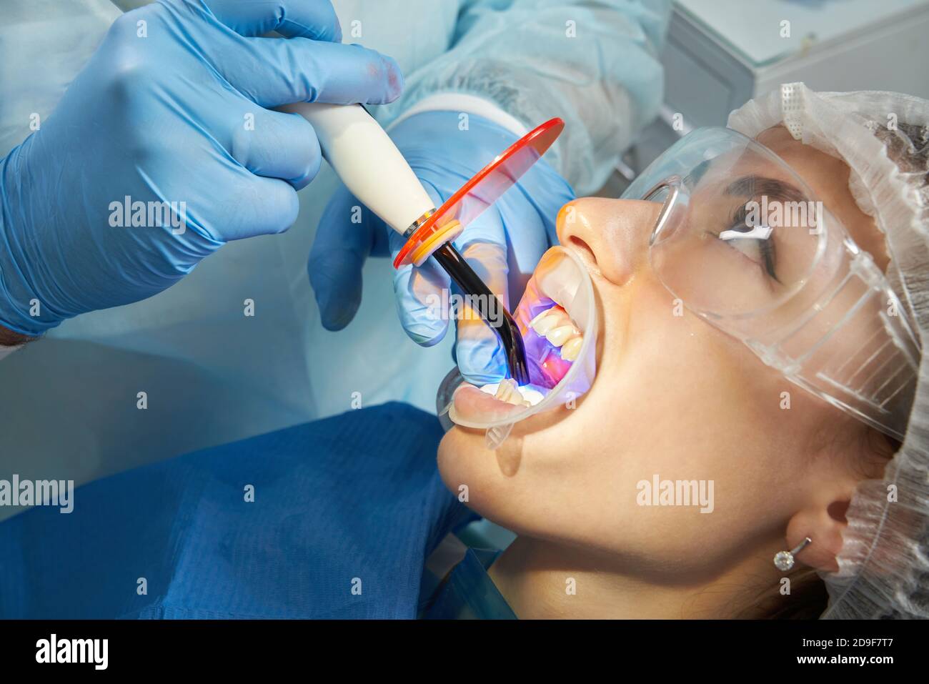 Zahnarzt tun Verfahren mit zahnmedizinischen Härtung mit UV-Licht in der Klinik Stockfoto