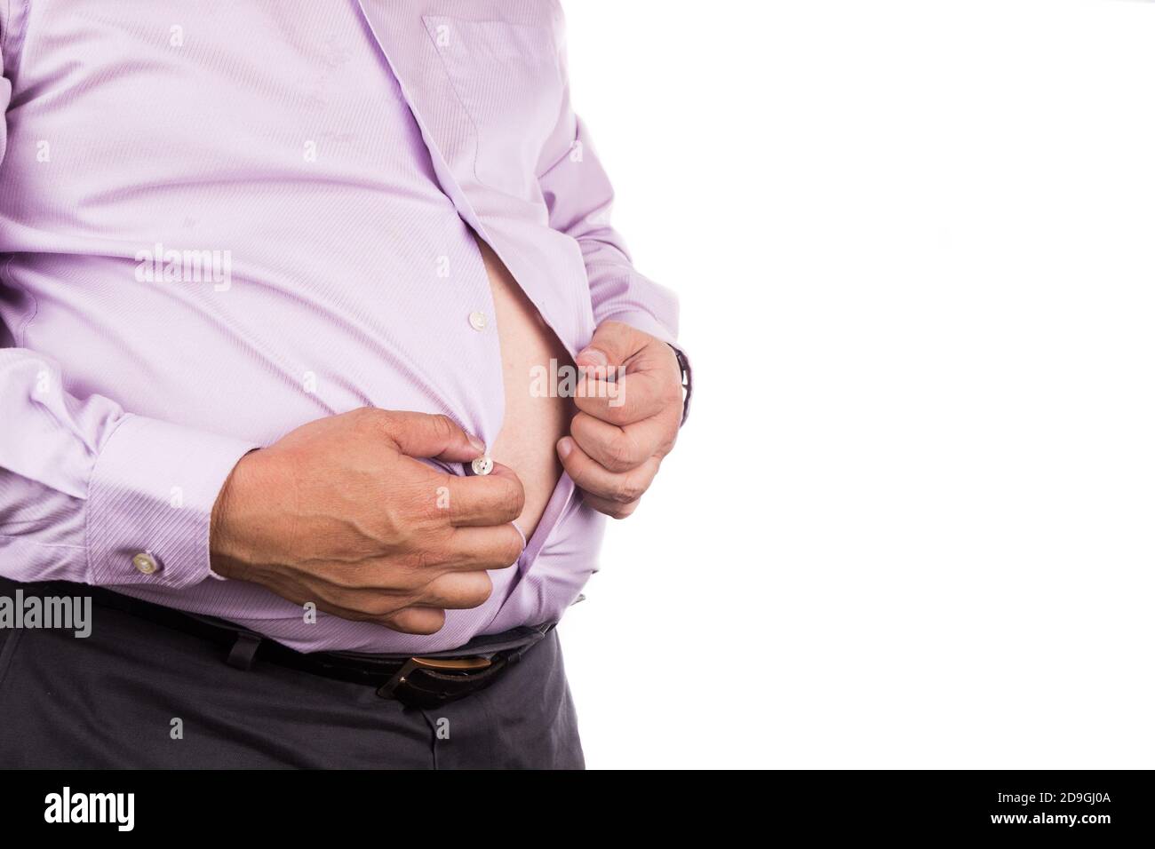 Mann mit ungesunden großen Bauch entknopf enge Hemd zu Erleichterung  Stockfotografie - Alamy