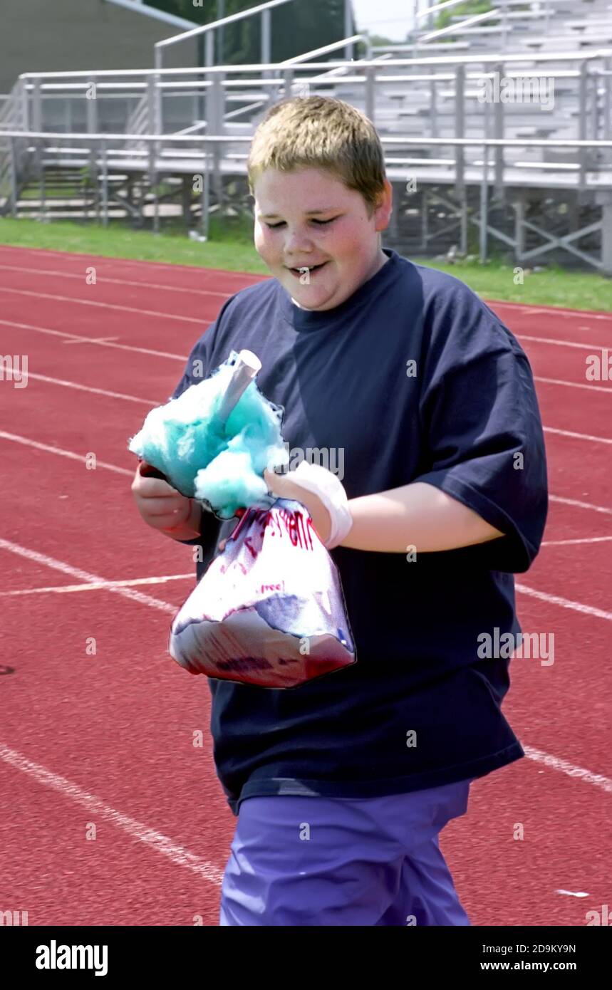 Obese teen boy belly -Fotos und -Bildmaterial in hoher Auflösung – Alamy