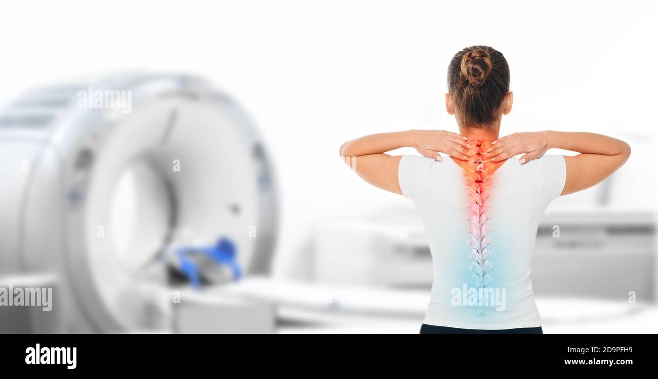 Medizinposter für CT-Scan menschliche Wirbelsäule. Frau mit Schmerzen in der Halswirbelsäule, die in der Nähe einer Tomographie steht Stockfoto
