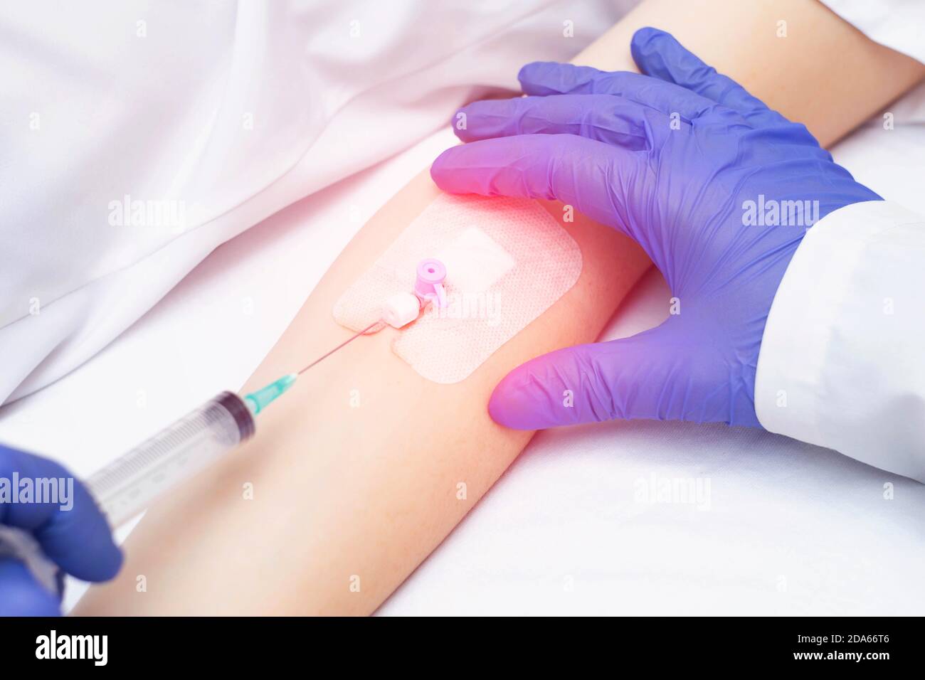 Ein Arzt legt einem Patienten einen Venenkatheter zur Injektion von Medikamenten in eine Vene, Nahaufnahme. Blutkreislauf-Krankheit Stockfoto