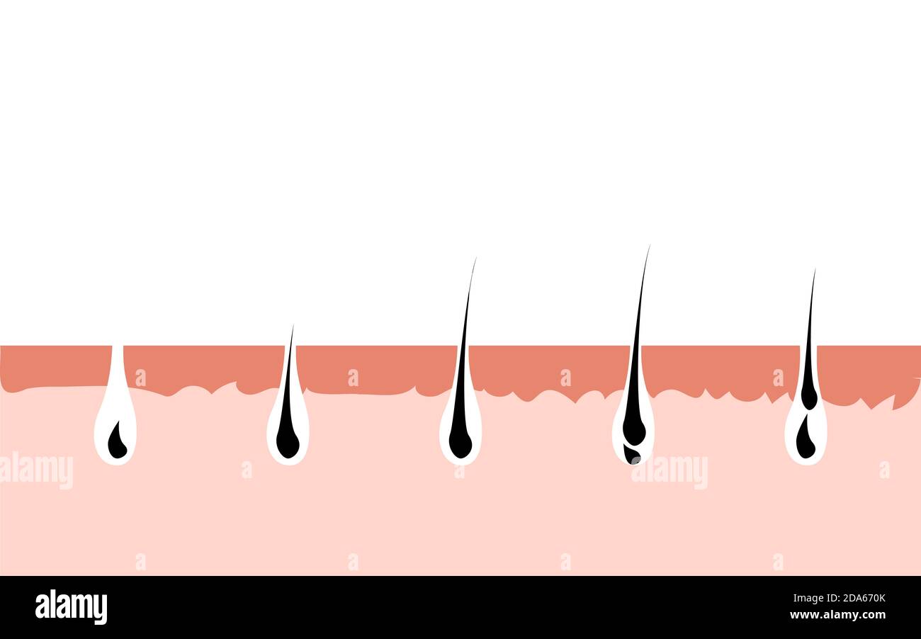 Haarwuchszyklus Haut. Follikel Anatomie Anagen Phase, Haarwachstum Diagramm Illustration Stock Vektor