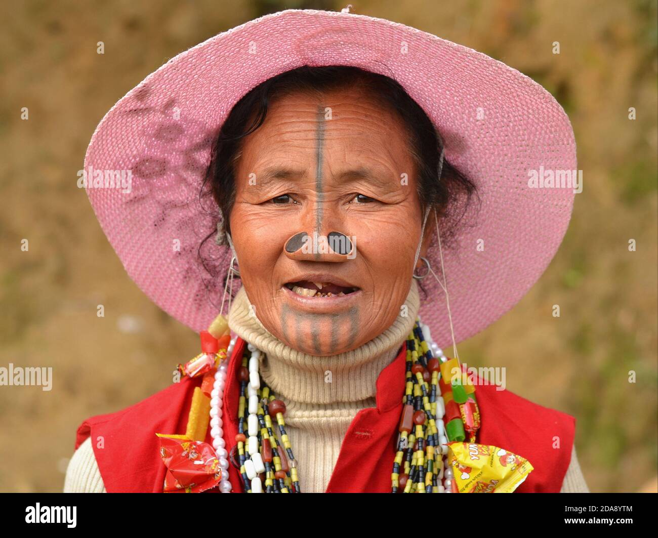 Ältere nordöstliche indische Apatani-Stammesfrau mit schwarzen Nasenstopfen und traditionellen Gesichts-Tattoos trägt einen rosa Sonnenhut und Posen für die Kamera. Stockfoto