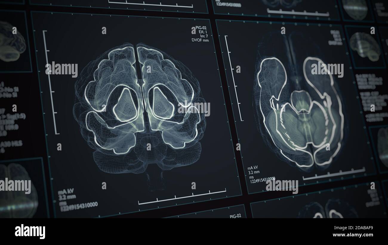 Magnetresonanz-MRT oder CT-Scan des Gehirns. 3D-Darstellung. Stockfoto