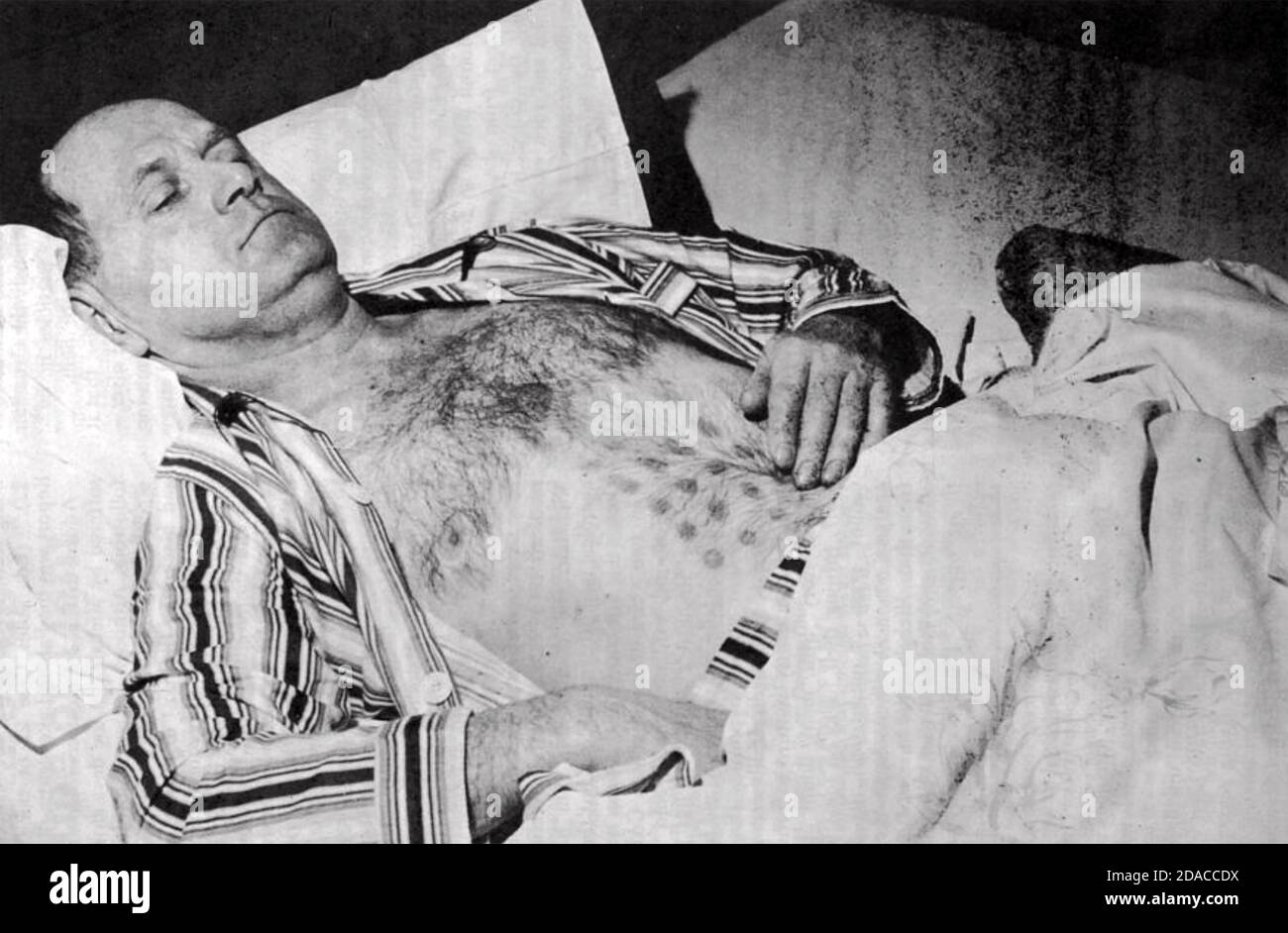 DIE FALCON LAKE VERANSTALTUNG Stefan Michalak nach seiner "Begegnung" mit einem UFO in Manitoba, Kanada, 20. Mai 1967 Stockfoto