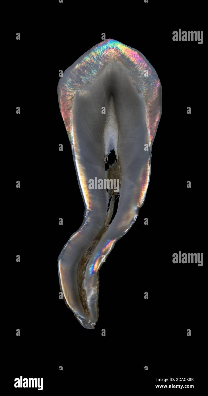 Kreuzpolarisierte Zahnscheibe, zahnärztliche Makrofotografie, oberer erster Prämolar. Stockfoto