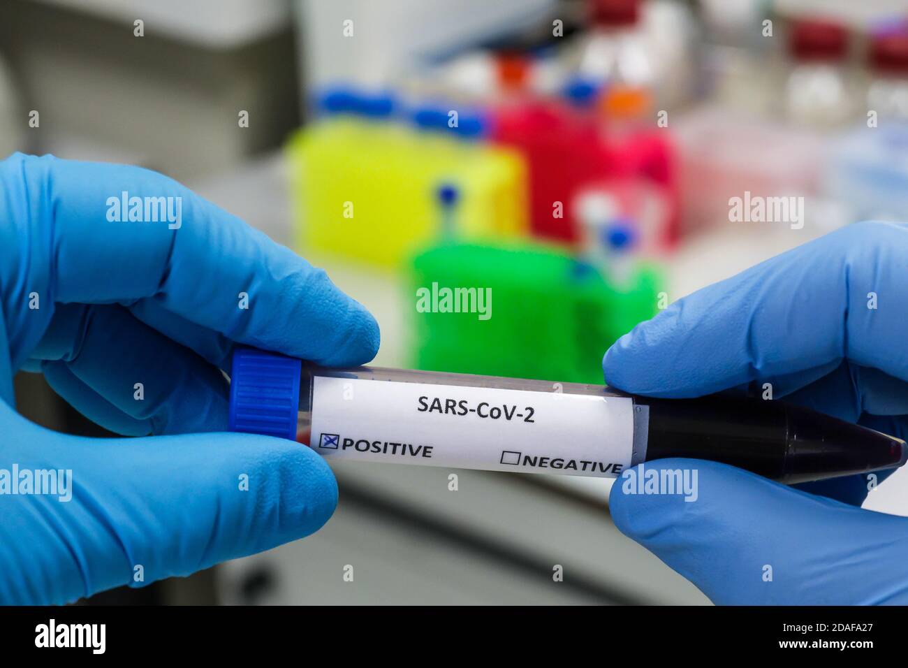 Tests für COVID-19. Testen einer biologischen Probe auf das Vorhandensein von Coronavirus. Stockfoto