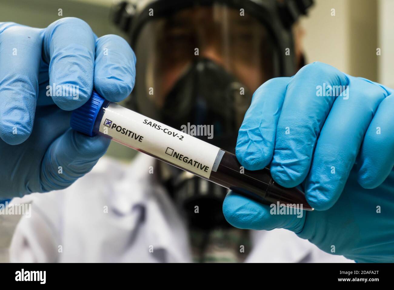 Tests für COVID-19. Testen einer biologischen Probe auf das Vorhandensein von Coronavirus. Stockfoto