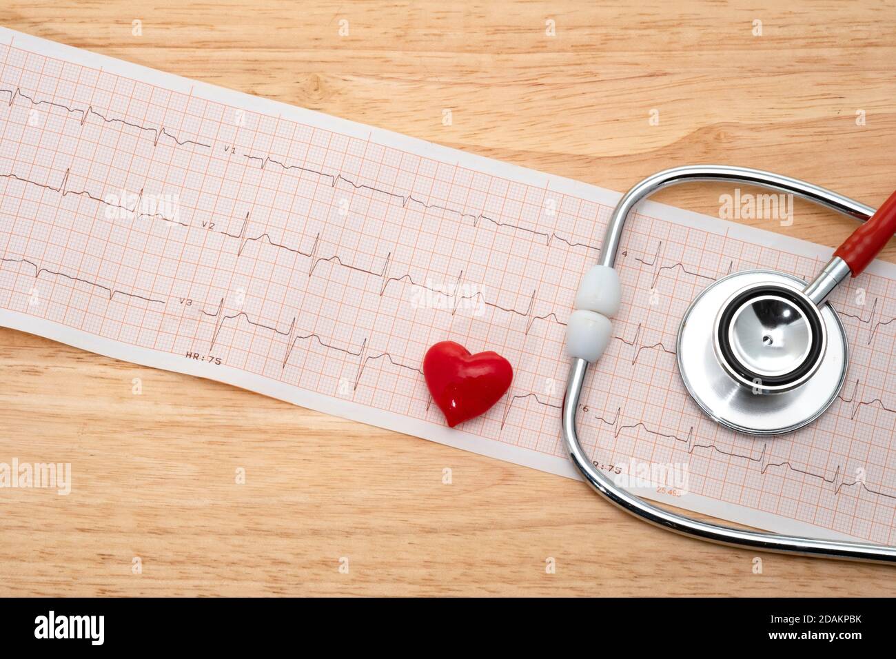 Ausdruck eines Stethoskops und eines EKG-Herzprotokolls Stockfoto