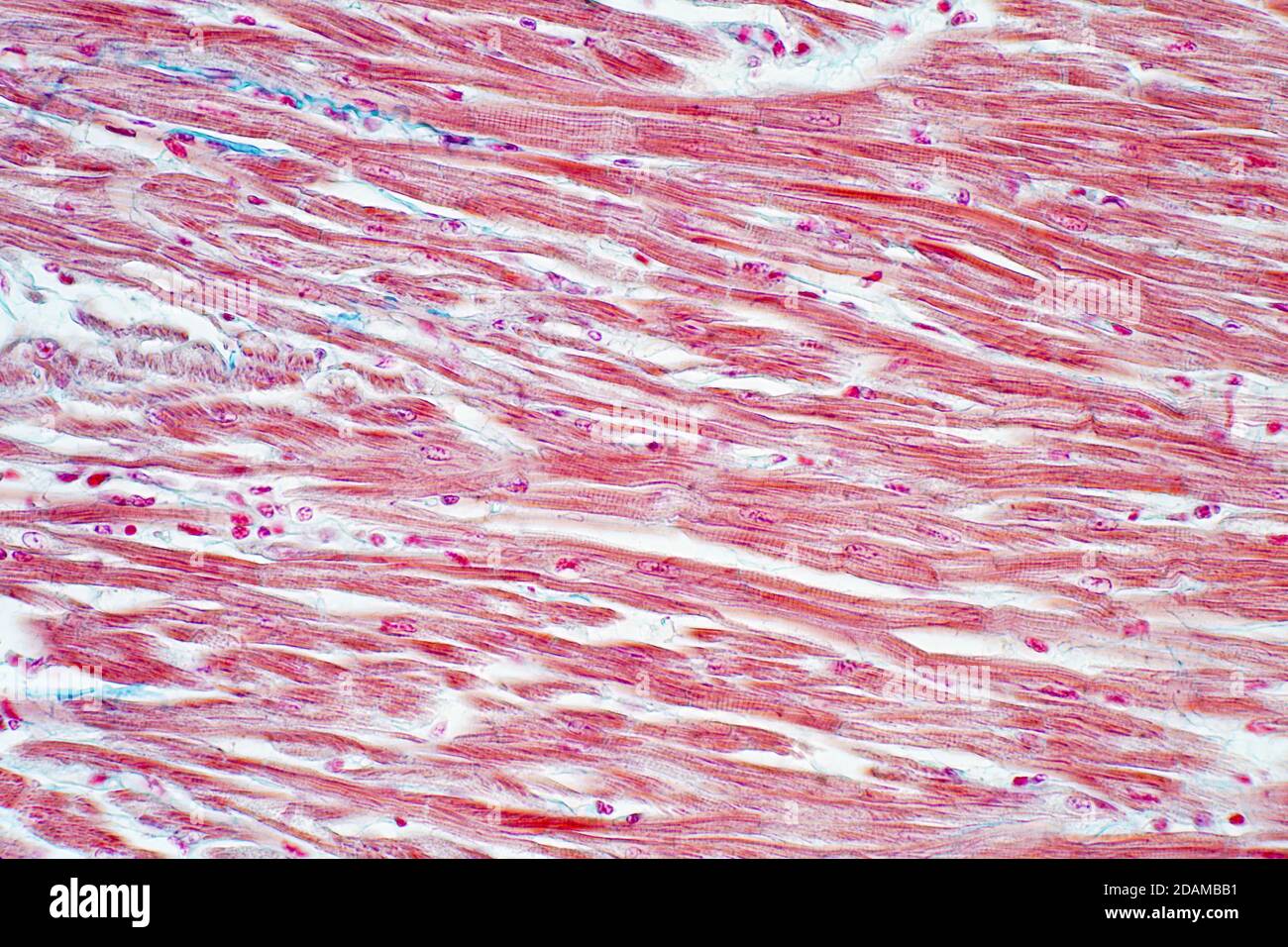 Menschlicher Herzmuskel, leichte Mikrograph. Stockfoto
