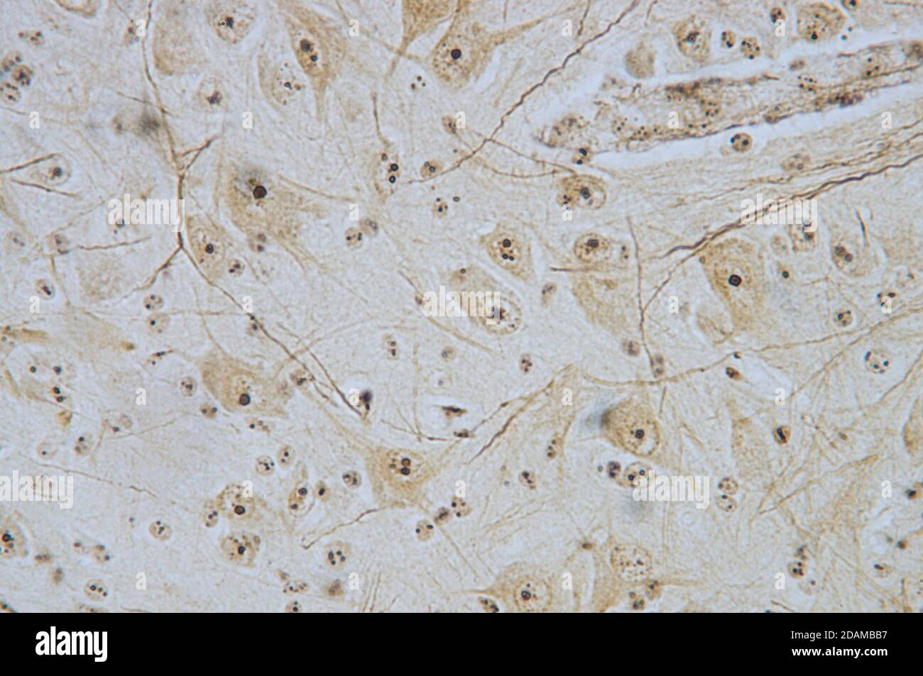 Leichte Mikrographie von Neuronen (Nervenzellen) aus dem Rückenmark. Stockfoto
