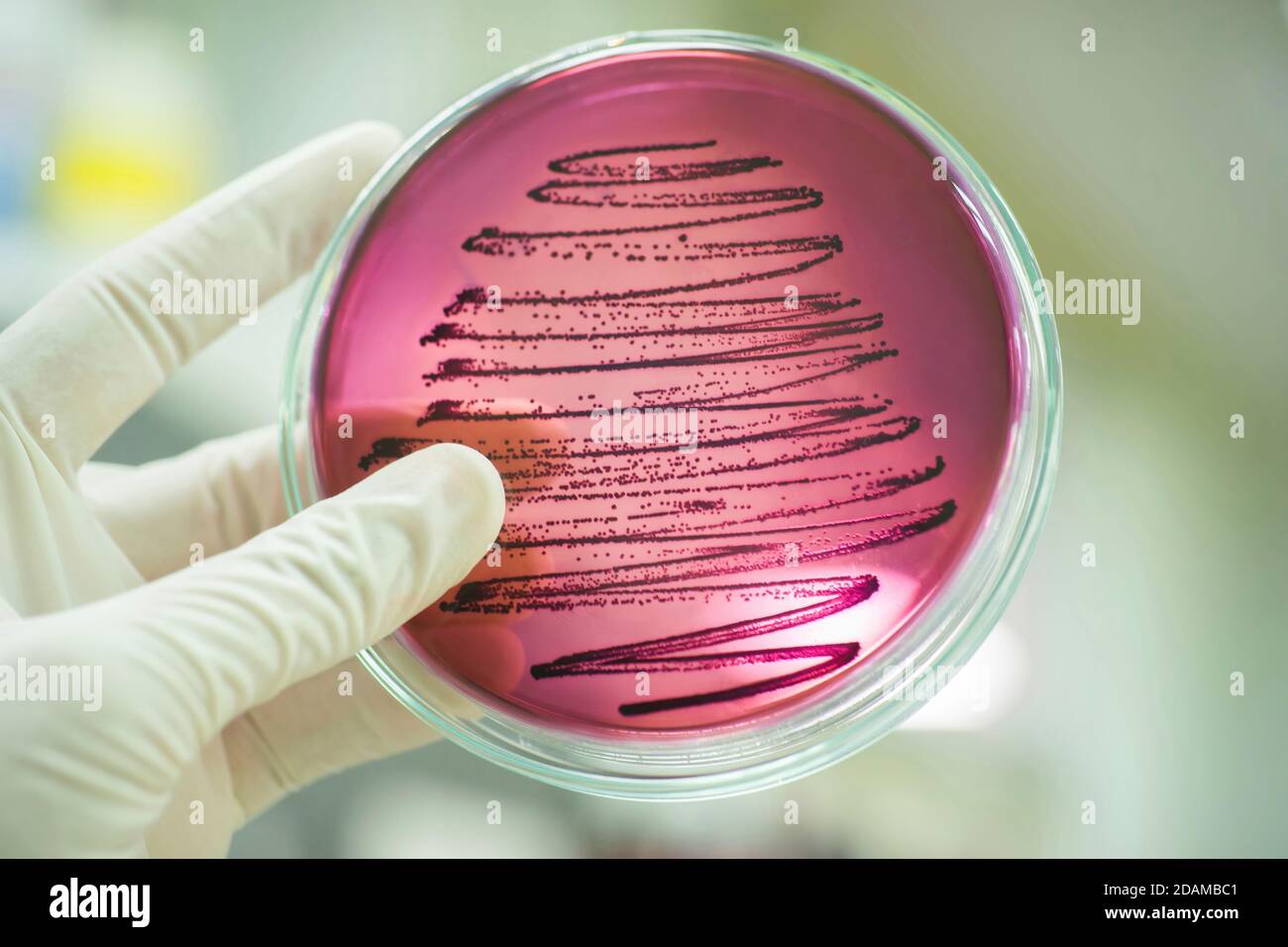 Wissenschaftler hält eine Petrischale mit einer Bakterienkultur. Stockfoto