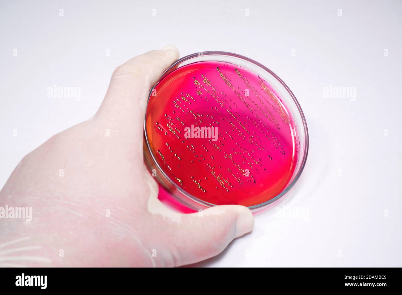 Escherichia coli Bakterien auf Blut-Agar-selektiven Medien. Stockfoto