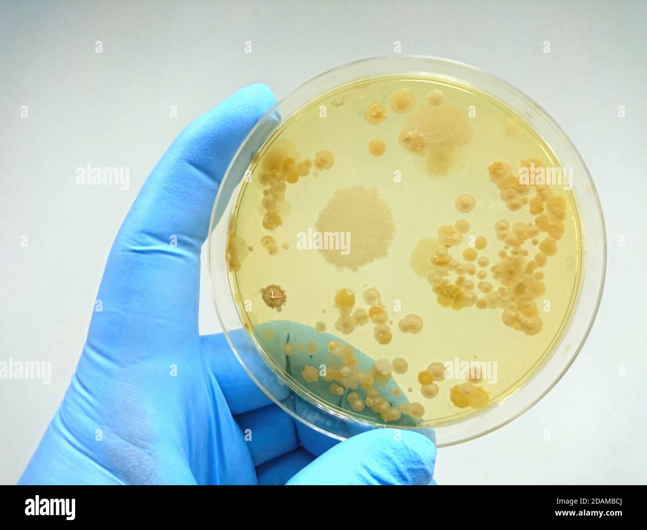 Kolonie von Bakterien auf Kulturmedium. Stockfoto