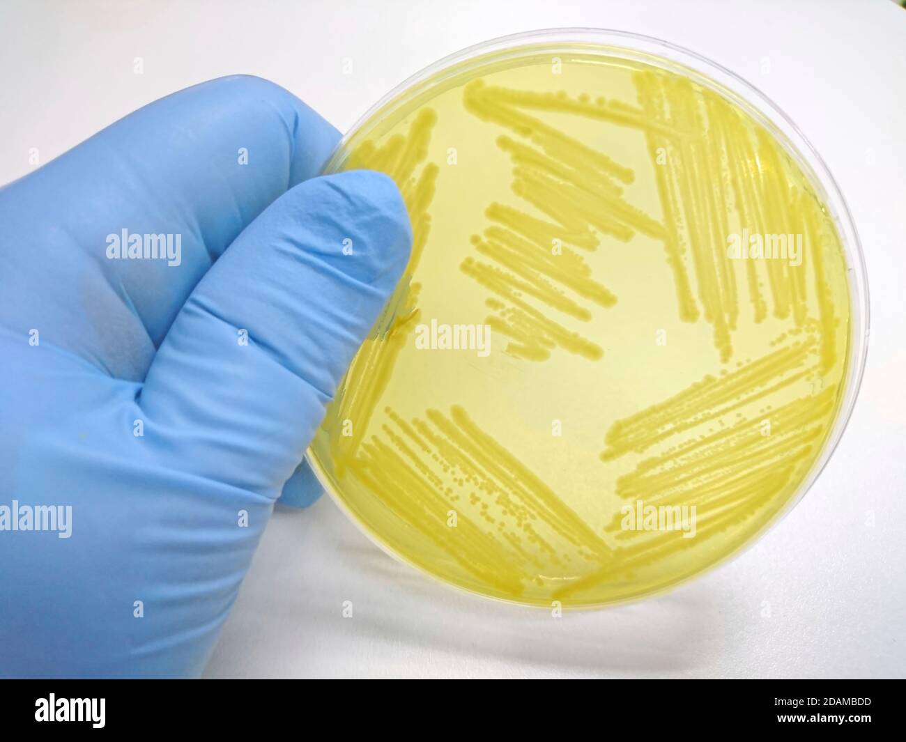 Kolonie von Bakterien auf Kulturmedium. Stockfoto