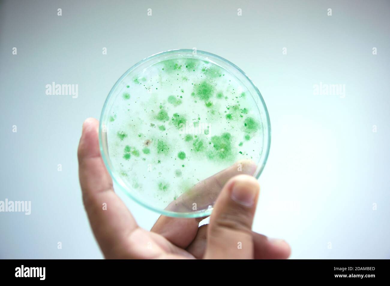 Kolonie von Cyanobakterien, oder Blaualgen, auf einer Nährstoffplatte. Stockfoto