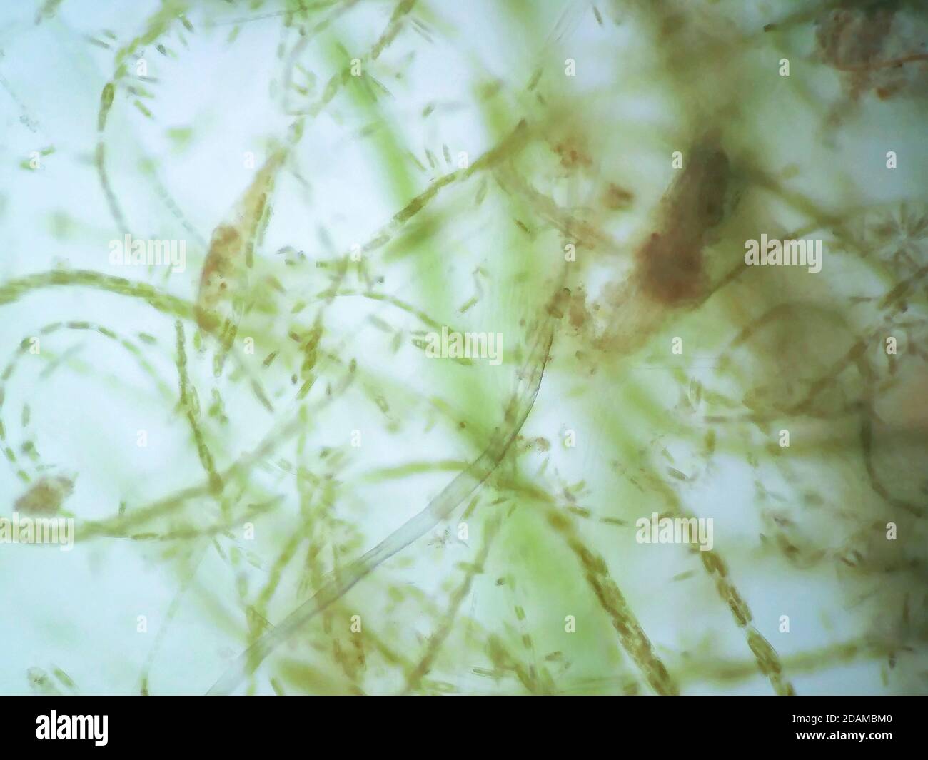 Filamentalgen, leichte Mikrograph. Filamentalgen sind einzelne Algenzellen, die lange sichtbare Ketten, Fäden oder Filamente bilden. Stockfoto