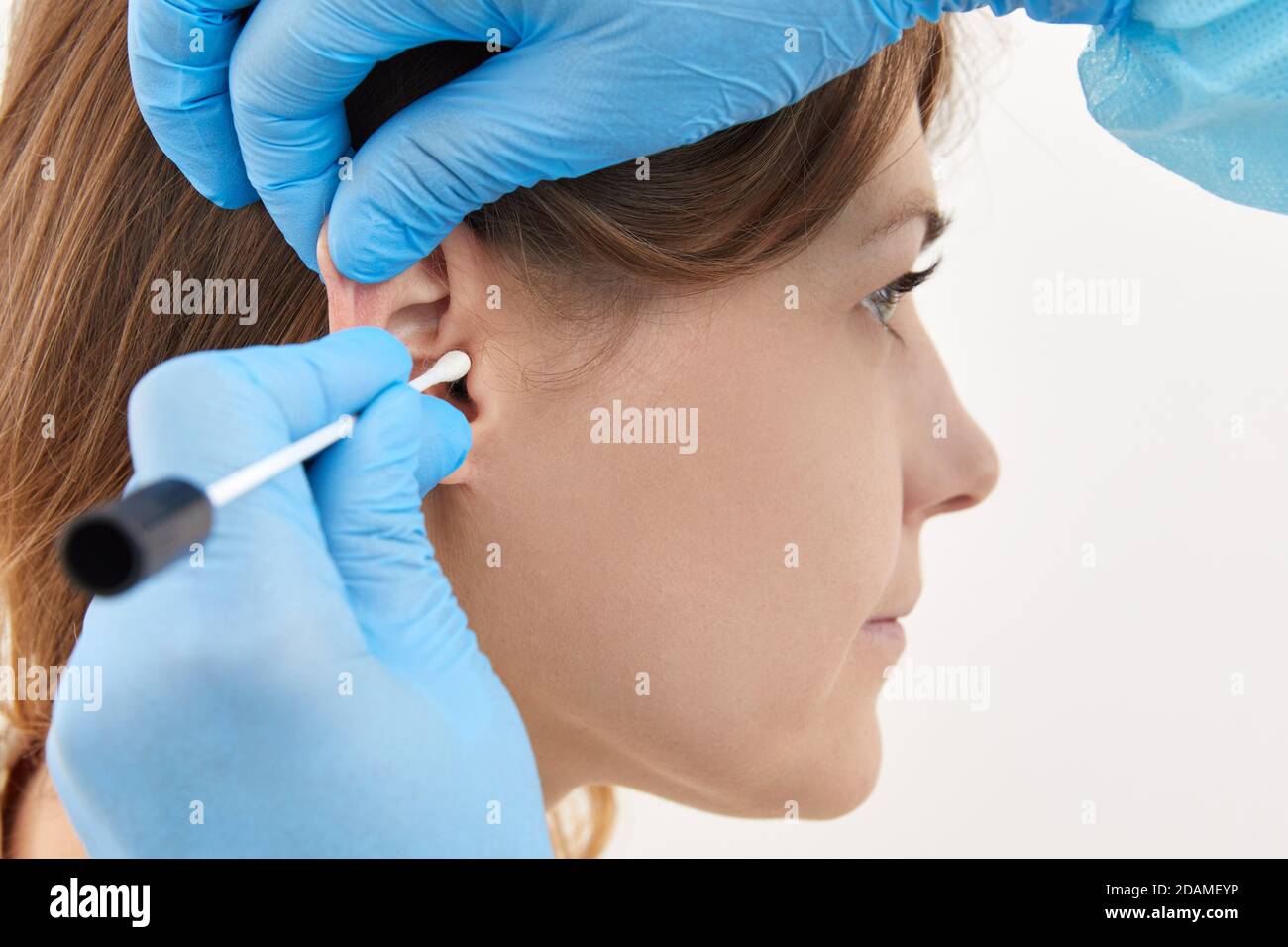 Ohrenkontrolle mit Wattestäbchen im medizinischen Labor Stockfoto