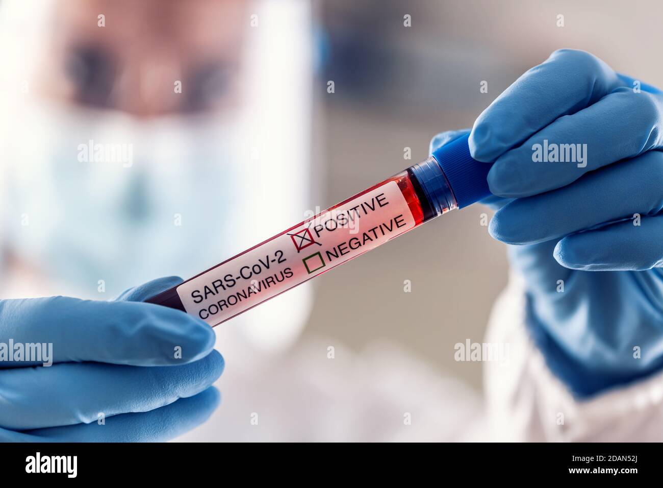 Detail of medical staff holding positive coronavirus test in protective gloves. Stockfoto