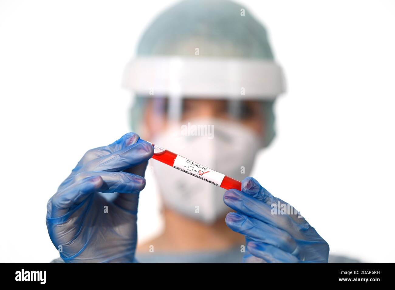 Positives Testergebnis, medizinisches Personal mit RT-PCR, Echtzeit-Reverse-Transkriptase-Polymerase-Kettenreaktion, Corona-Test, Corona-Krise Stockfoto