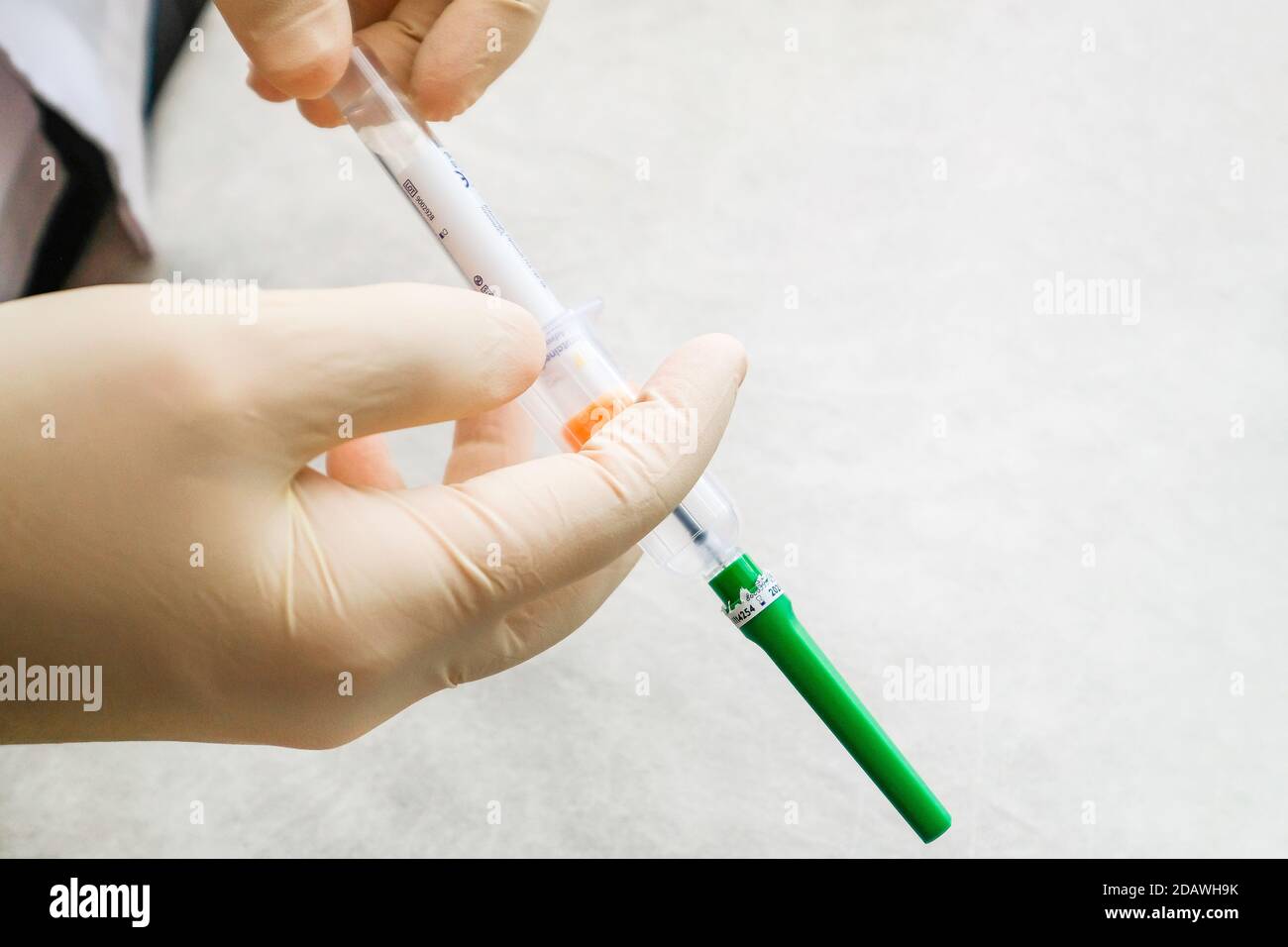 Eine Krankenschwester mit Handschuhen hält ein Vakuumsystem für die Probenentnahme. Stockfoto