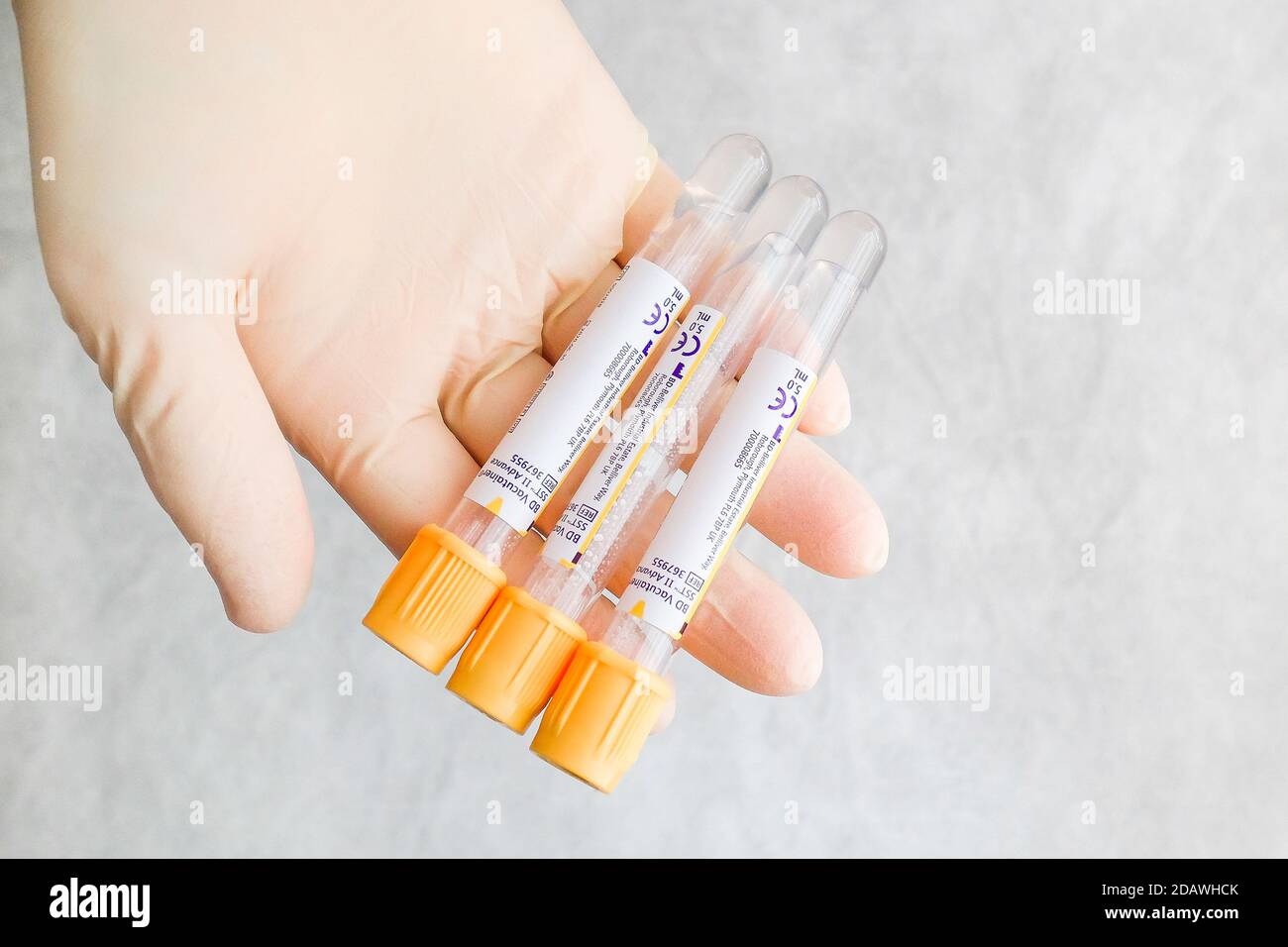 Auf einer Handfläche mit Handschuhen befinden sich drei Vakuumröhrchen für die Blutentnahme zur Analyse. Stockfoto