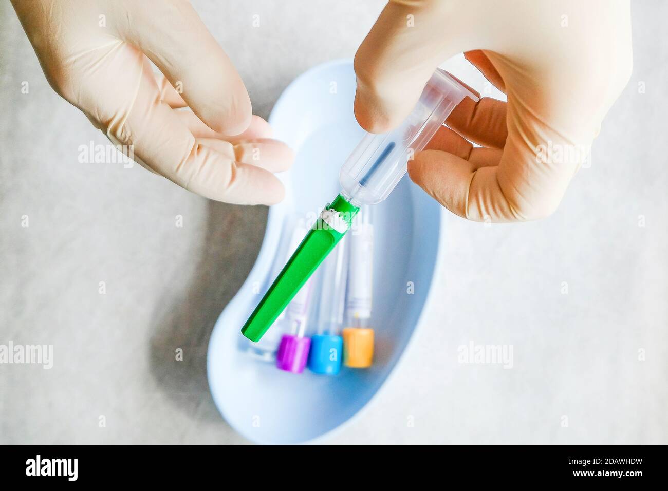 Farbige Reagenzgläser befinden sich in einem Behälter. Eine Handschuhen hält das Gerät Stockfoto