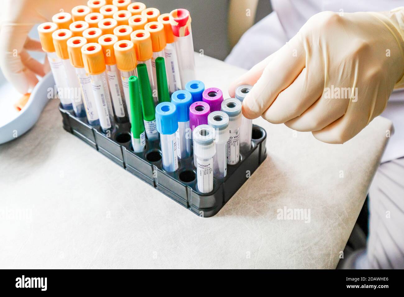 Die Krankenschwester arbeitet mit Reagenzgläsern und Instrumenten. Stockfoto