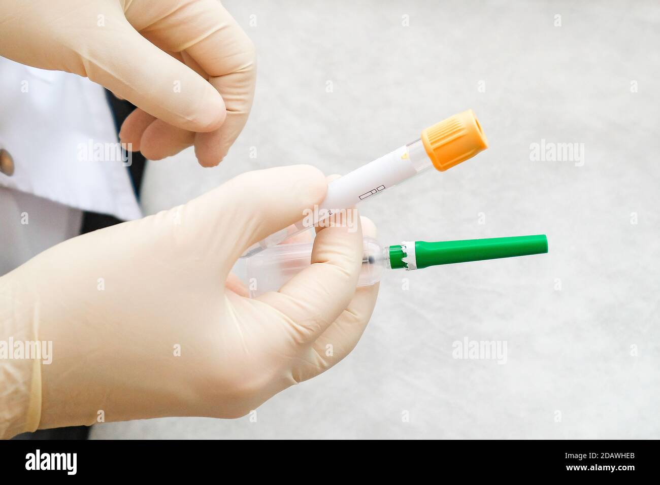 Eine Krankenschwester mit Handschuhen hält ein Vakuumsystem für die Einnahme Beispiele Stockfoto
