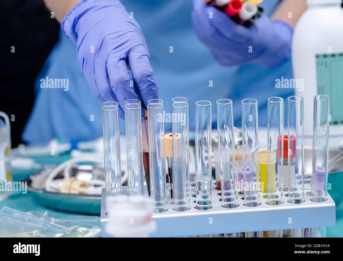 Krankenschwester Blutproben, die in einem Krankenhaus, Konzept Bild Stockfoto