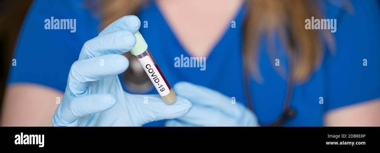 Reagenzglas in der Hand eines Laboranten mit einer Probe des Coronavirus Covid-19, eines tödlichen globalen Pandemiekonzepts Stockfoto