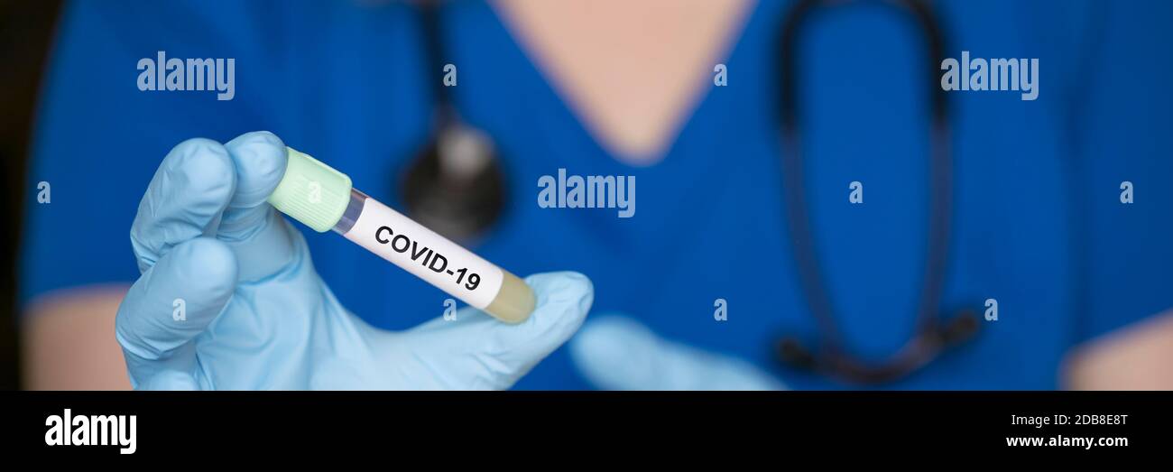 Reagenzglas in der Hand eines Laboranten mit einer Probe des Coronavirus Covid-19, eines tödlichen globalen Pandemiekonzepts Stockfoto